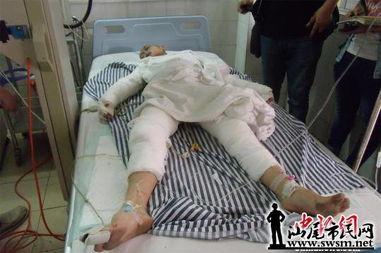 烧伤人视频,紧急救援烧伤患者现场纪实